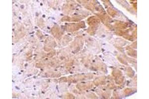 Immunohistochemistry of CIDE-A in mouse heart tissue with CIDE-A antibody at 5 μg/ml. (CIDEA antibody  (C-Term))