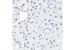 Immunohistochemistry of paraffin-embedded rat liver using HIST2H2BE antibody. (HIST2H2BE antibody)