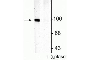 Western blot of rat hippocampal lysate showing specific immunolabeling of the ~100 kDa GluR1 protein phosphorylated at Ser831 in the first lane (-). (Glutamate Receptor 1 antibody  (pSer831))