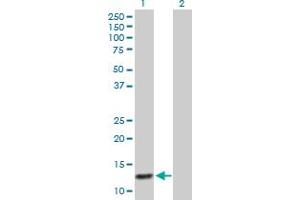 Western Blot analysis of ABCC6 expression in transfected 293T cell line by ABCC6 MaxPab polyclonal antibody. (ABCC6 antibody  (AA 1-99))