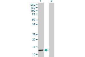 Western Blot analysis of ABCC6 expression in transfected 293T cell line by ABCC6 MaxPab polyclonal antibody. (ABCC6 antibody  (AA 1-99))