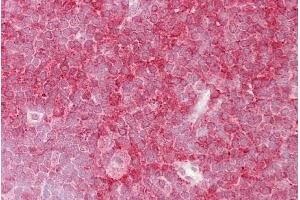 Thymus (MCM6 antibody  (C-Term))