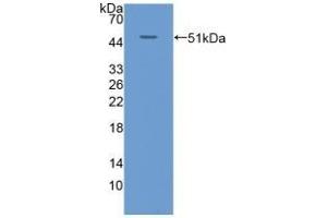 Detection of Recombinant KRT20, Human using Polyclonal Antibody to Cytokeratin 20 (CK 20) (KRT20 antibody  (AA 9-424))