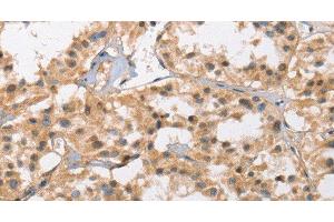 Immunohistochemistry (Paraffin-embedded Sections) (IHC (p)) image for anti-Calcium Channel, Voltage-Dependent, L Type, alpha 1D Subunit (CACNA1D) antibody (ABIN7243073)