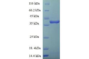 SDS-PAGE (SDS) image for ETXG / Enterotoxin G (AA 26-258) protein (His-SUMO Tag) (ABIN5711026) (ETXG / Enterotoxin G (AA 26-258) protein (His-SUMO Tag))