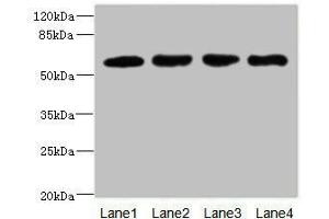 Western blot All lanes: IL21R antibody at 2. (IL21 Receptor antibody  (AA 20-240))