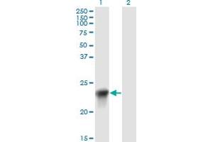 Western Blot analysis of BLVRB expression in transfected 293T cell line by BLVRB monoclonal antibody (M09), clone 2F4. (BLVRB antibody  (AA 107-206))