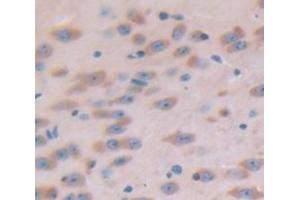 Figure. (SEMA3A antibody  (AA 31-150))