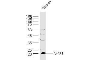 Mouse spleen lysates probed with Rabbit Anti-GPX1 Polyclonal Antibody, Unconjugated  at 1:300 overnight at 4˚C.