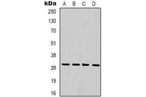 Western blot analysis of PCNA expression in Hela (A), 293T (B), NIH3T3 (C), rat brain (D) whole cell lysates. (PCNA antibody)