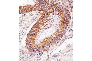 Immunohistochemical analysis of paraffin-embedded H. (ICT1 antibody  (C-Term))