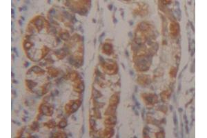 IHC-P analysis of Human Stomach Tissue, with DAB staining. (Cytokeratin 18 antibody  (AA 238-396))