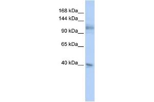 WB Suggested Anti-MSH2 Antibody Titration:  0.