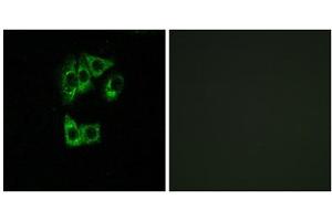 Immunofluorescence analysis of A549 cells, using GIMAP2 antibody.