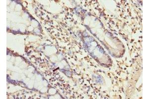 Immunohistochemistry of paraffin-embedded human small intestine tissue using ABIN7174649 at dilution of 1:100 (UGT3A2 antibody  (AA 23-300))
