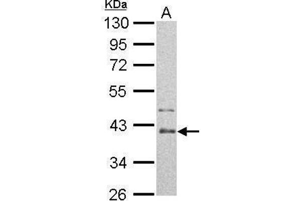 ARG2 antibody  (Center)