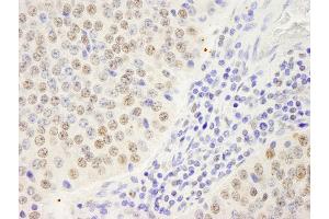 Immunohistochemistry (IHC) image for anti-Symplekin (SYMPK) (AA 1224-1274) antibody (ABIN7448822)