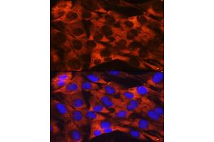 Immunofluorescence analysis of C6 cells using RPS19 Rabbit mAb (ABIN1681275, ABIN3017969, ABIN3017970 and ABIN7101552) at dilution of 1:100 (40x lens). (RPS19 antibody)