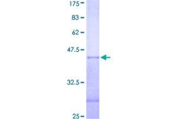 PRPF4B Protein (AA 581-680) (GST tag)