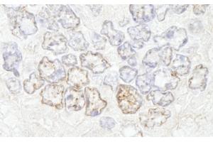 Immunohistochemistry (IHC) image for anti-Nucleoporin 50kDa (NUP50) (AA 418-468) antibody (ABIN7448703) (NUP50 antibody  (AA 418-468))