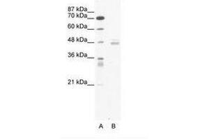 Image no. 1 for anti-LIM Domain Binding 1 (LDB1) (AA 251-300) antibody (ABIN6736052) (LIM Domain Binding 1 Protein antibody  (AA 251-300))