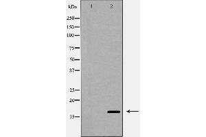 Western blot analysis of Interleukin 4 expression in MCF-7 cells,The lane on the left is treated with the antigen-specific peptide. (IL-4 antibody  (Internal Region))
