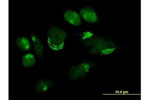 Immunofluorescence of purified MaxPab antibody to B4GALT4 on HeLa cell. (B4GALT4 antibody  (AA 1-344))