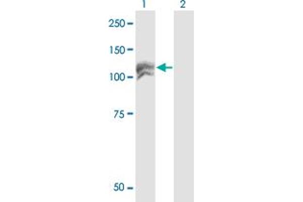 NEDD4-2 antibody  (AA 1-100)