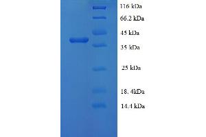SDS-PAGE (SDS) image for PHOSP (AA 1-297), (full length) protein (His tag) (ABIN5710678)