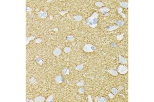 Immunohistochemistry of paraffin-embedded human brain using STXBP1 Rabbit mAb (ABIN7270689) at dilution of 1:100 (40x lens). (STXBP1 antibody)