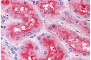Human Kidney: Formalin-Fixed, Paraffin-Embedded (FFPE) (ACOT9 antibody  (AA 1-213))