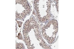 Immunohistochemical analysis of A on paraffin-embedded Human testis tissue. (BRD9 antibody  (N-Term))