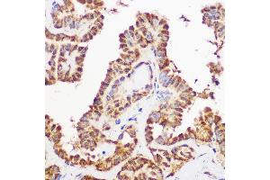 Immunohistochemistry of paraffin-embedded human thyroid using Pan-AKT antibody (ABIN7265519) at dilution of 1:100 (40x lens).