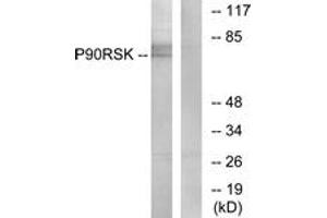 Western blot analysis of extracts from NIH-3T3 cells, treated with PMA 125ng/ml 30', using p90 RSK (Ab-573) Antibody.