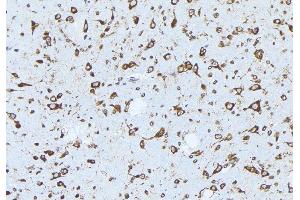 Immunohistochemistry (IHC) image for anti-Receptor Tyrosine-Protein Kinase ErbB-3 (ERBB3) (pTyr1289) antibody (ABIN6255799)