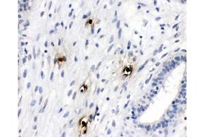 IHC analysis of Mast Cell Tryptase using anti-Mast Cell Tryptase antibody (ABIN4886754). (TPSAB1 antibody  (AA 65-275))