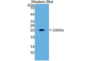 Western Blotting (WB) image for anti-Erythropoietin (EPO) (AA 28-192) antibody (ABIN1078000) (EPO antibody  (AA 28-192))