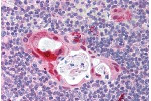 anti-Toll-Like Receptor 6 (TLR6) (N-Term) antibody