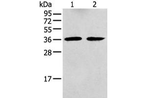 Western blot analysis of Mouse brain tissue and Human fetal brain tissue using GNAI2 Polyclonal Antibody at dilution of 1:400