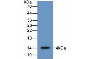 Detection of Recombinant SFRP4, Human using Monoclonal Antibody to Secreted Frizzled Related Protein 4 (SFRP4) (SFRP4 antibody  (AA 22-346))
