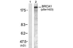 Image no. 1 for anti-Breast Cancer 1 (BRCA1) (pSer1423) antibody (ABIN273605) (BRCA1 antibody  (pSer1423))