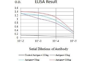 Black line: Control Antigen (100 ng),Purple line: Antigen (10 ng), Blue line: Antigen (50 ng), Red line:Antigen (100 ng) (Caspase 6 antibody  (AA 194-293))