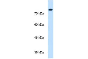WB Suggested Anti-SNF1LK Antibody Titration:  1. (SIK1 antibody  (N-Term))