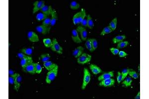 Immunofluorescent analysis of HepG2 cells using ABIN7169719 at dilution of 1:100 and Alexa Fluor 488-congugated AffiniPure Goat Anti-Rabbit IgG(H+L) (SLAMF1 antibody  (AA 69-204))