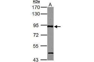WB Image ABR antibody [C3], C-term detects ABR protein by Western blot analysis.