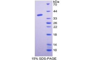Image no. 1 for General Transcription Factor IIE, Polypeptide 1, alpha 56kDa (GTF2E1) (AA 15-306) protein (His tag) (ABIN6237932) (GTF2E1 Protein (AA 15-306) (His tag))