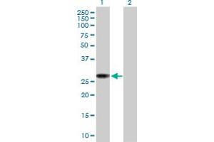 Western Blot analysis of NAT9 expression in transfected 293T cell line by NAT9 MaxPab polyclonal antibody. (NAT9 antibody  (AA 1-207))