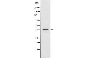 Western blot analysis of extracts from HUVEC cells, using AIM2 antibody. (AIM2 antibody  (Internal Region))