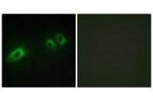 Immunofluorescence analysis of HeLa cells, using LAMB1 antibody. (Laminin beta 1 antibody  (C-Term))
