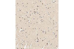 Immunohistochemistry (Paraffin-embedded Sections) (IHC (p)) image for anti-Ubiquitin Specific Peptidase 17-Like Family Member 24 (USP17L24) (AA 496-524), (C-Term) antibody (ABIN651682)